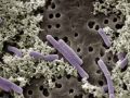 Лакто-бактерии. Видимо фиолетовые.